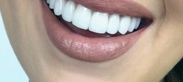 Shining Smiles Dentistry