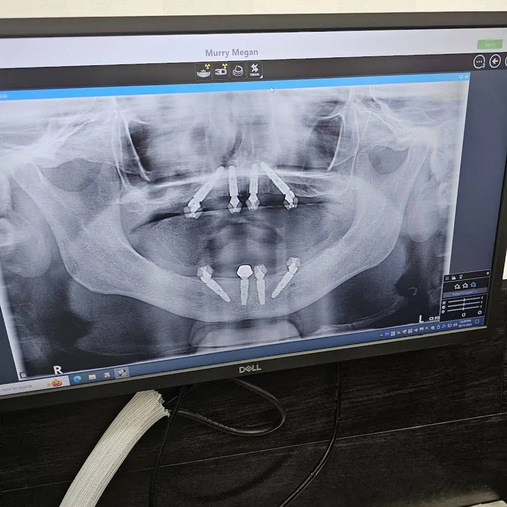 Bionic Smile Las Vegas