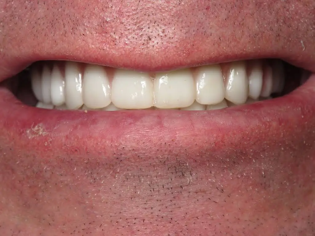Winegar Prosthodontics