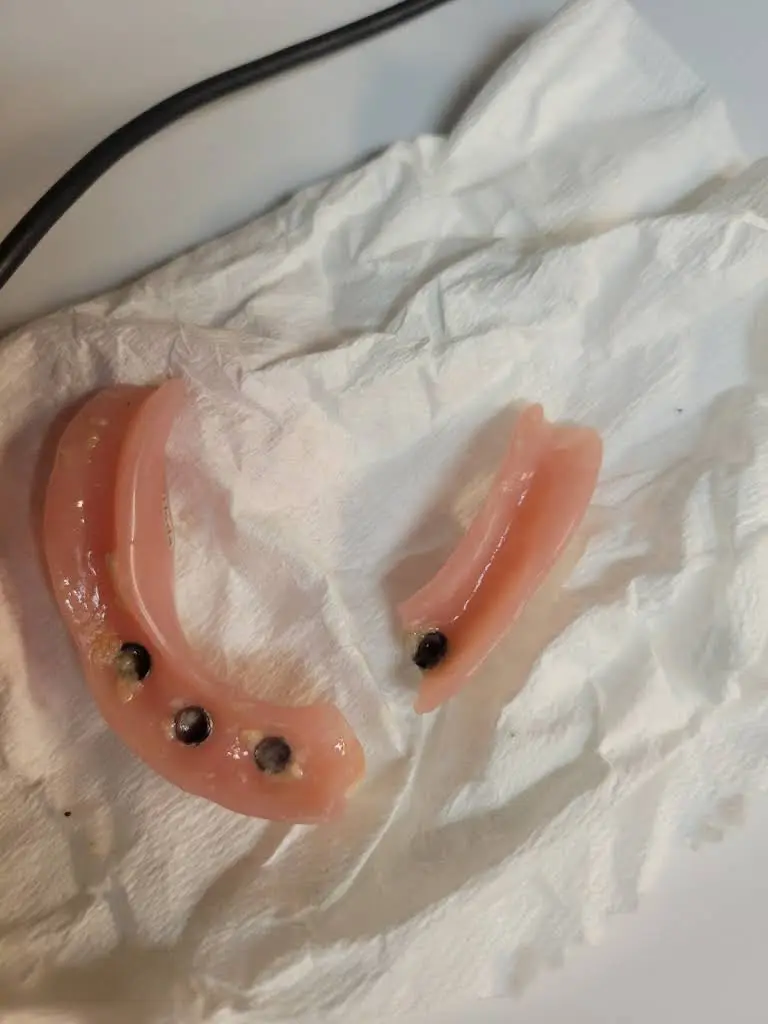 Affordable Dentures & Implants