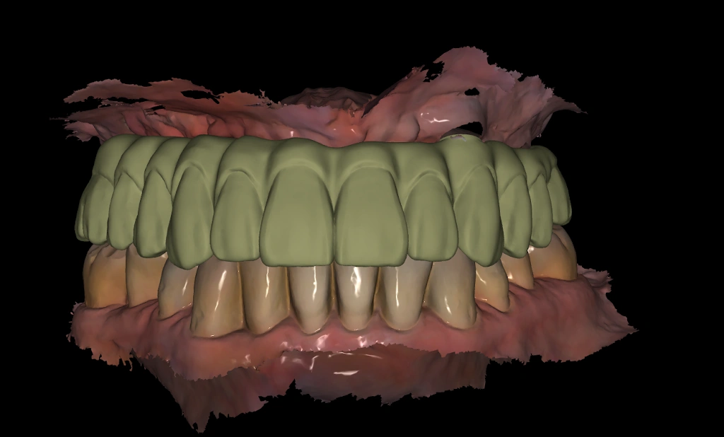 Dream Dental Implant Center