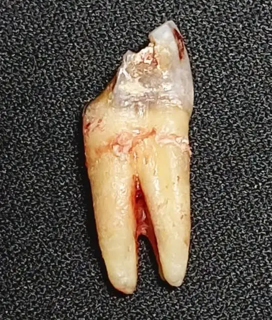 Dream Dental Implant Center