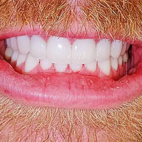 Amazing Smile Dentistry