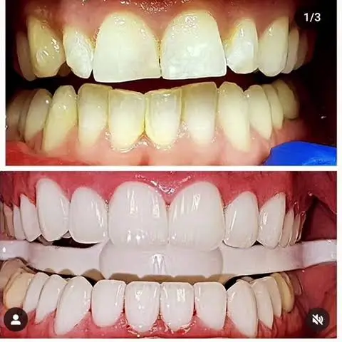 Amazing Smile Dentistry