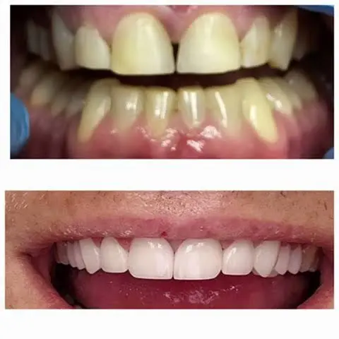 Amazing Smile Dentistry