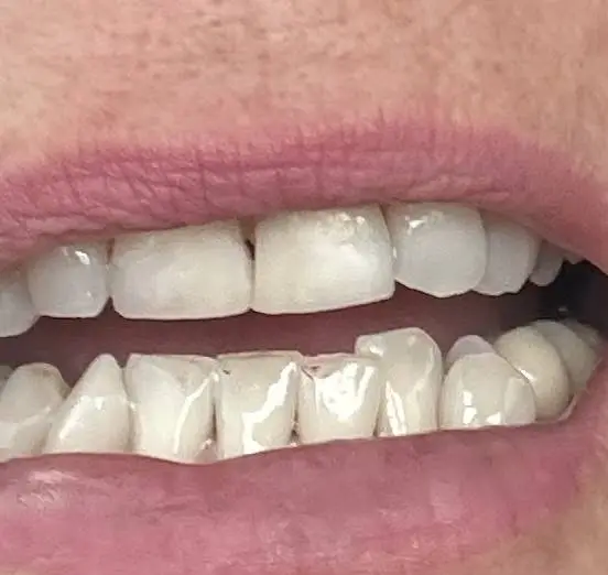 Aloha Dental Las Vegas