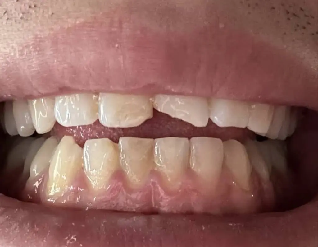 LV Dental