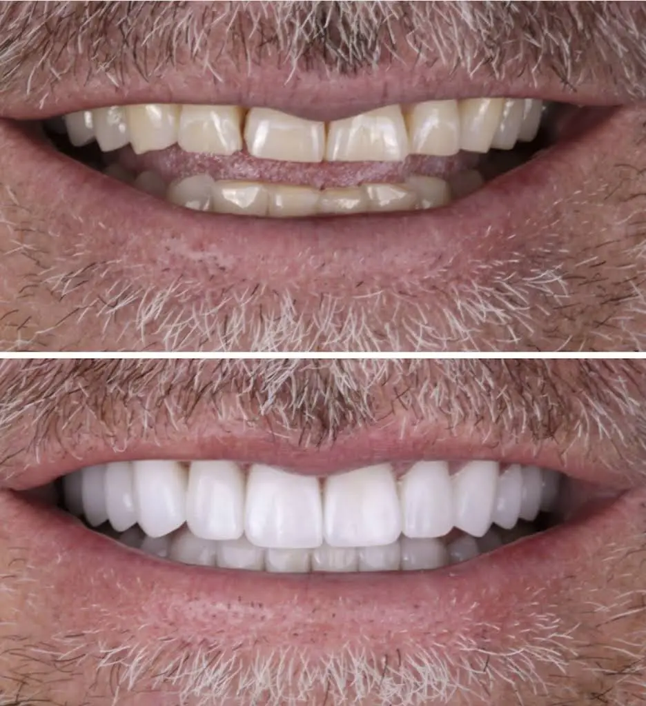 Vegas Smile Suite