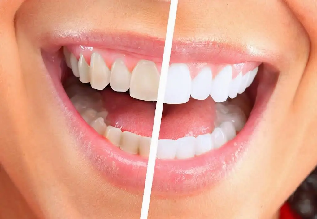 Milner Dentistry