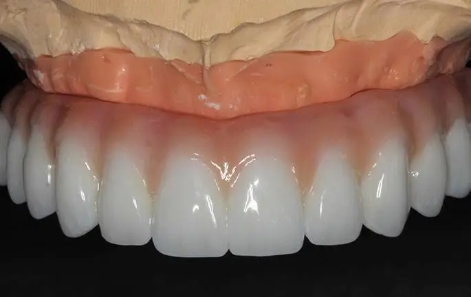 Pony Express Dental & Orthodontics