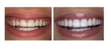 Young Family Dental