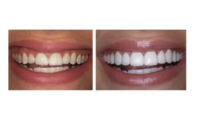 Young Family Dental