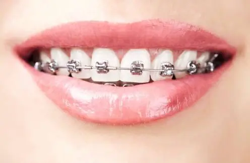 Young Family Dental