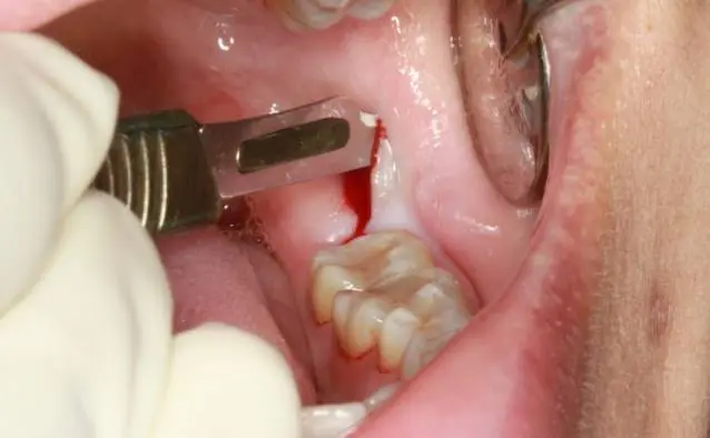 Young Family Dental