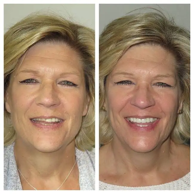 White Pine Dental