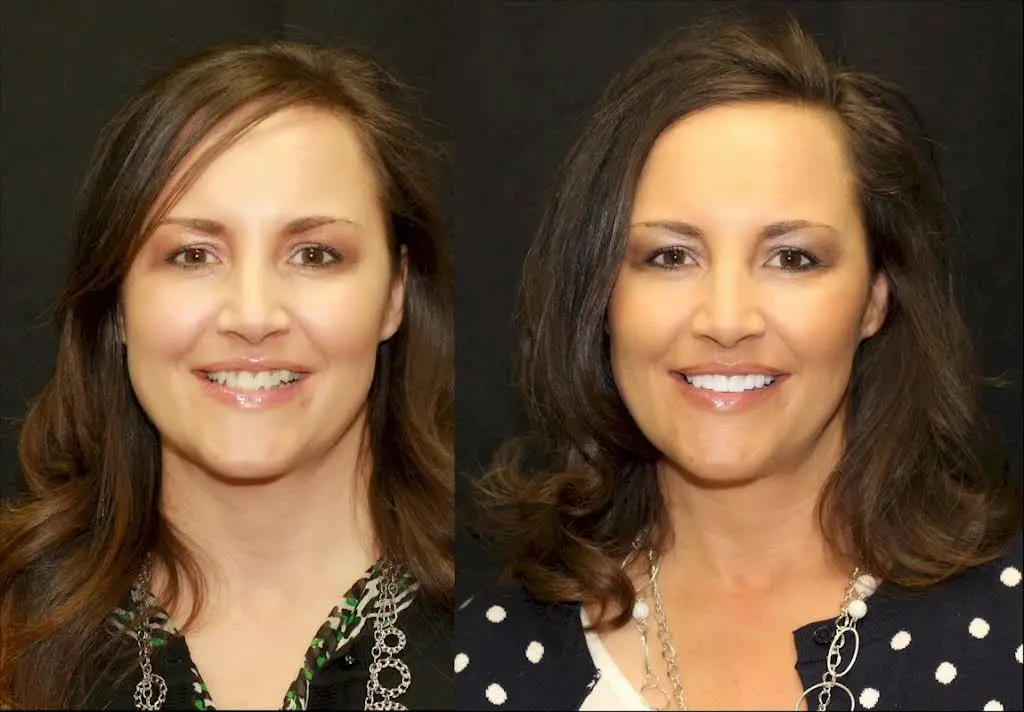 Intermountain Smiles