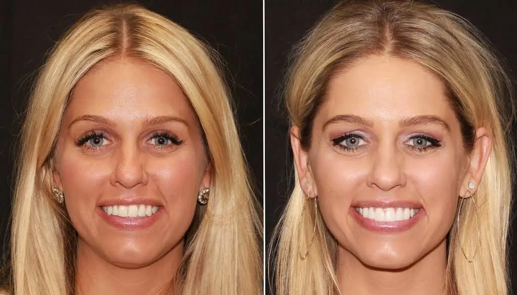 Intermountain Smiles