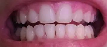 Pittsburgh Orthodontic Group