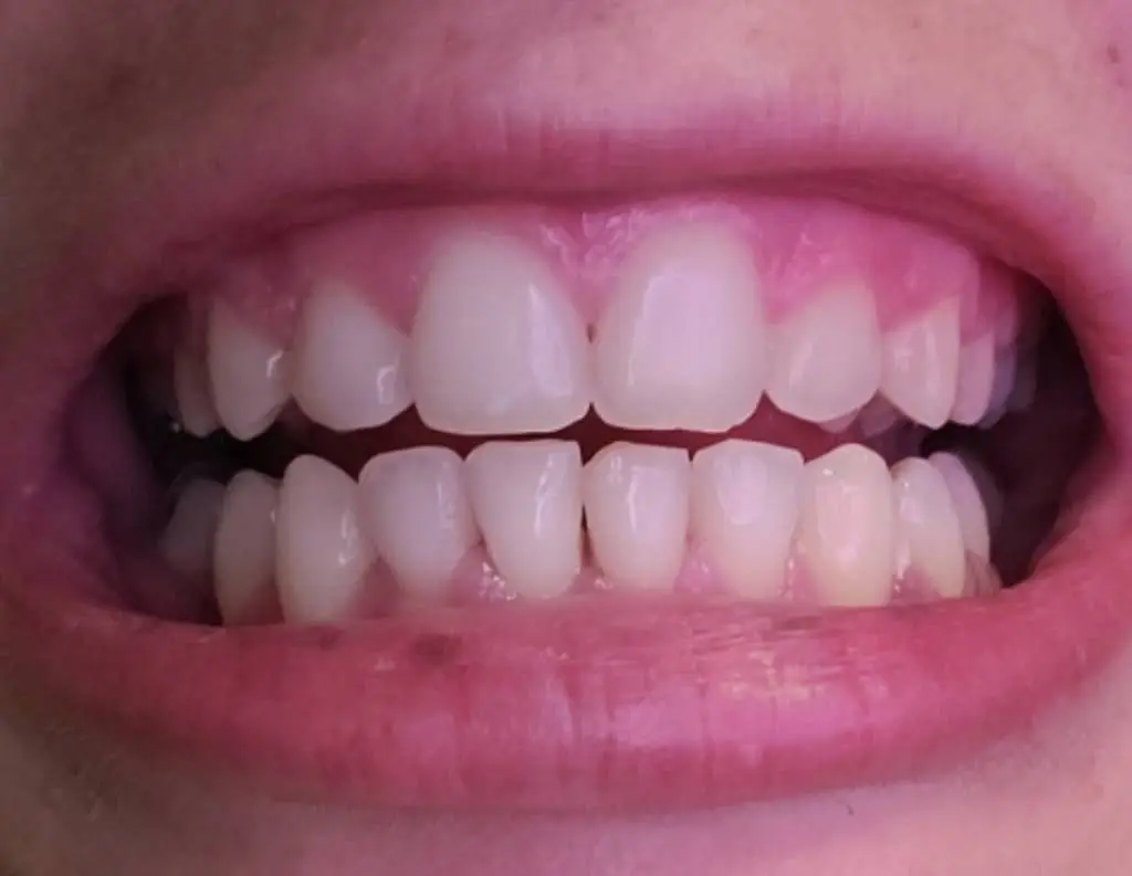 Pittsburgh Orthodontic Group