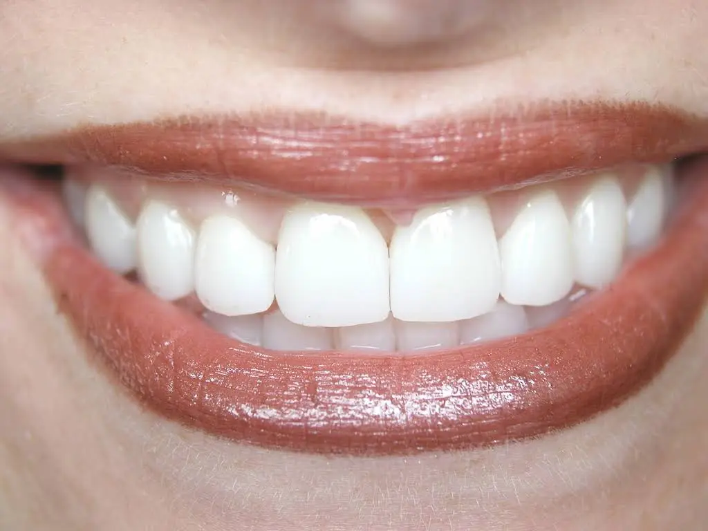 Smile By Design