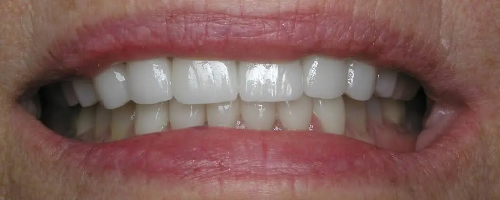 Smile By Design