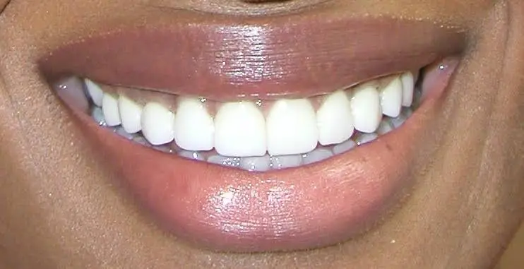 Smile By Design