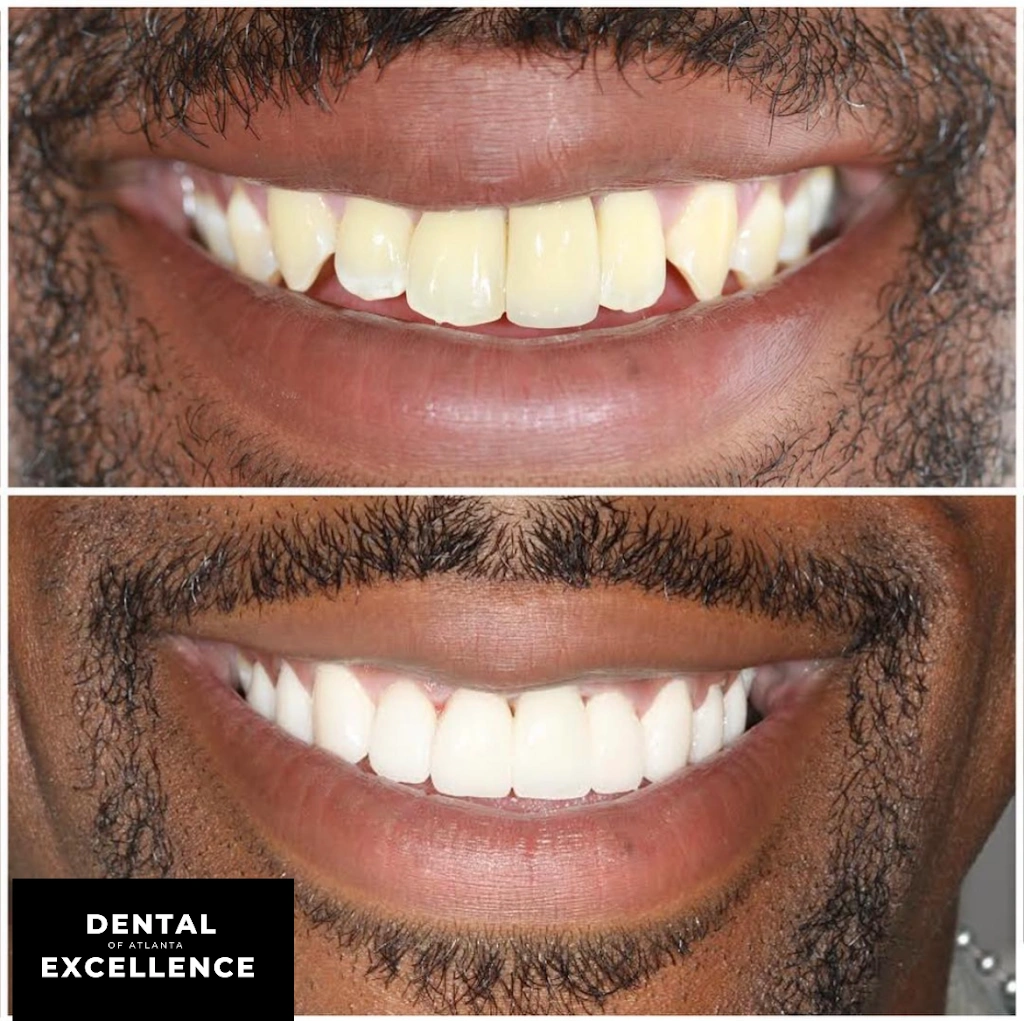 Dental Excellence of Atlanta
