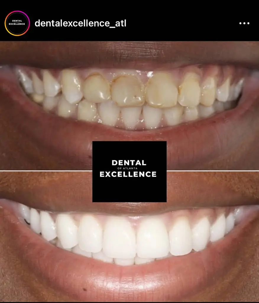 Dental Excellence of Atlanta