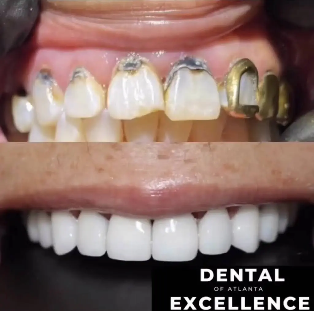 Dental Excellence of Atlanta