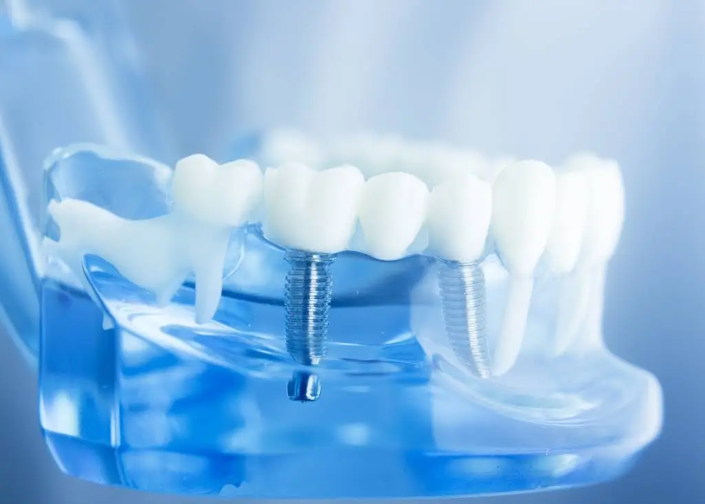 Mountain Crest Dental