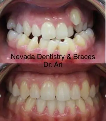 Nevada Dentistry & Braces