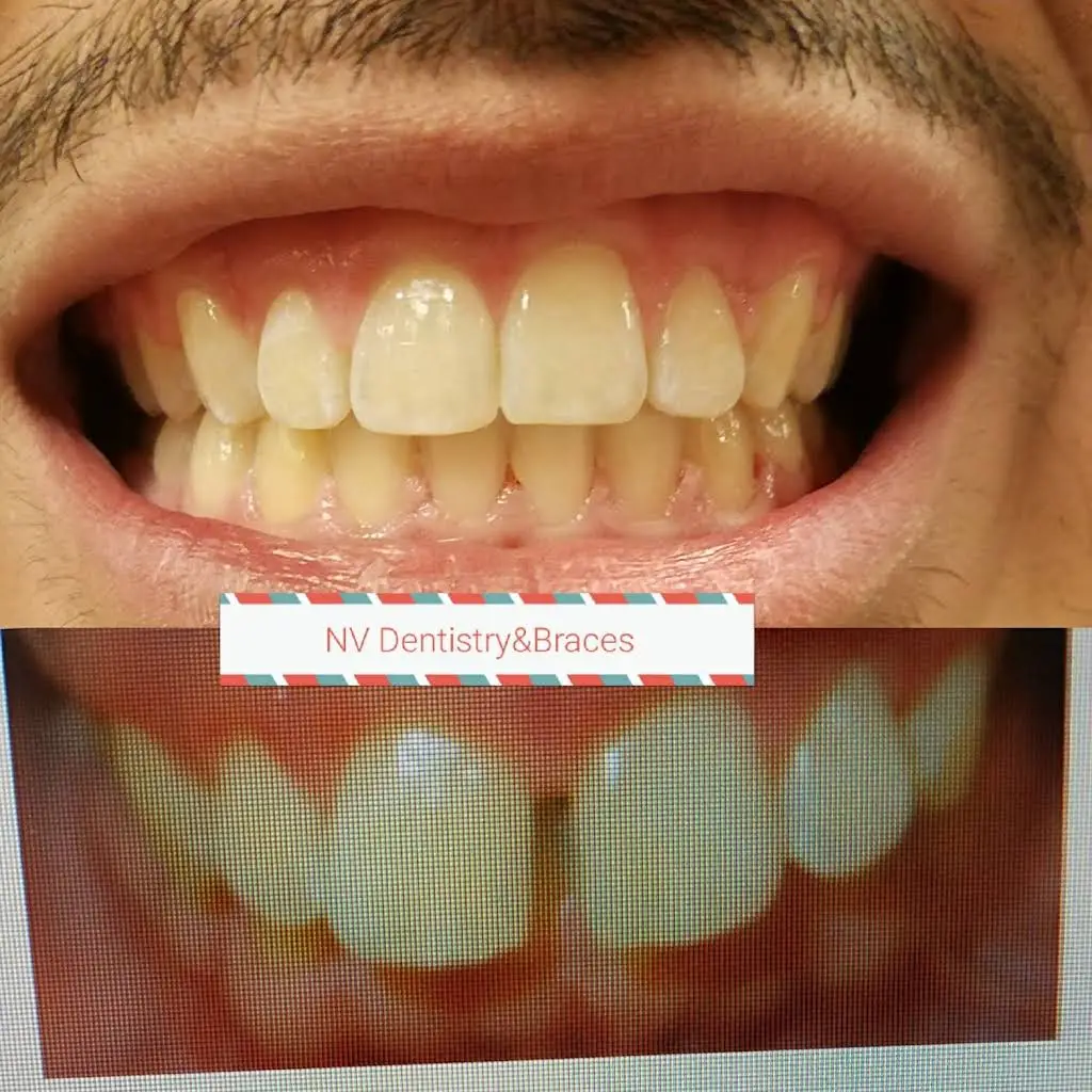 Nevada Dentistry & Braces