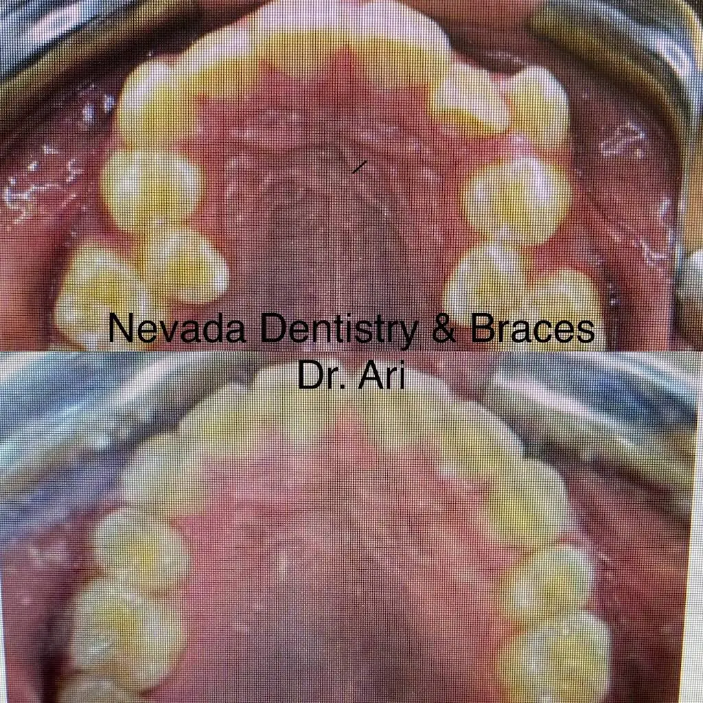 Nevada Dentistry & Braces