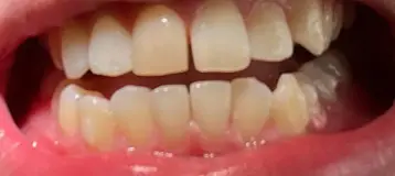 Brilliant Smiles Family Dental