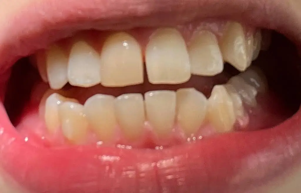 Brilliant Smiles Family Dental