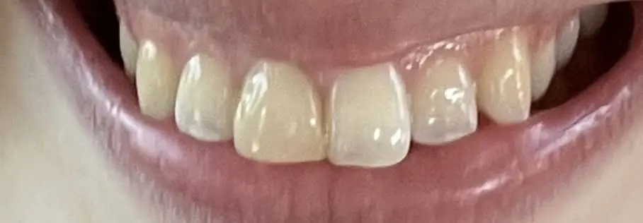 Brilliant Smiles Family Dental