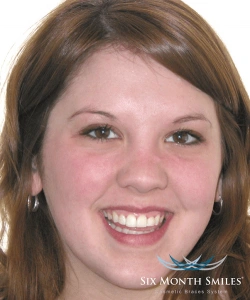 Brilliant Smiles Family Dental