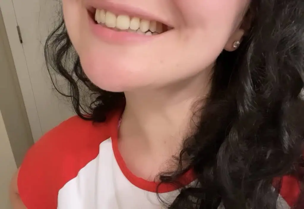 Blooming Braces