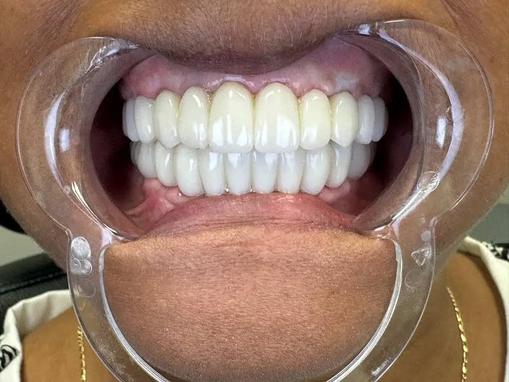 All Out Dental
