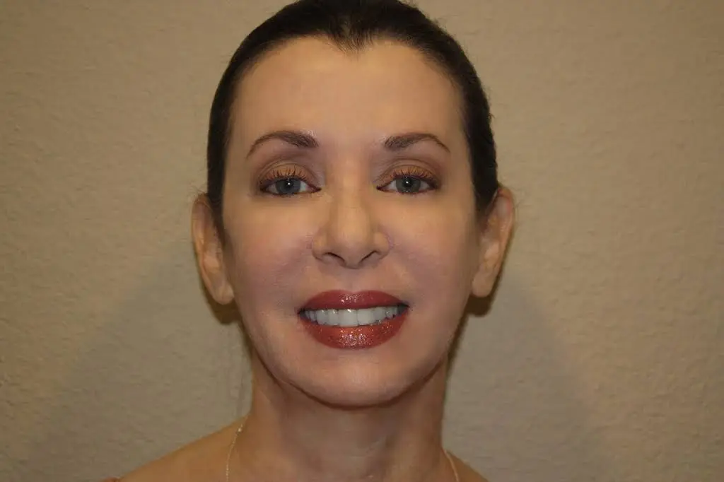 Enhance Dental