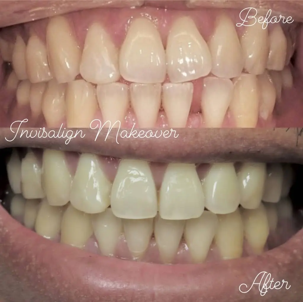 North Avenue Dental Care