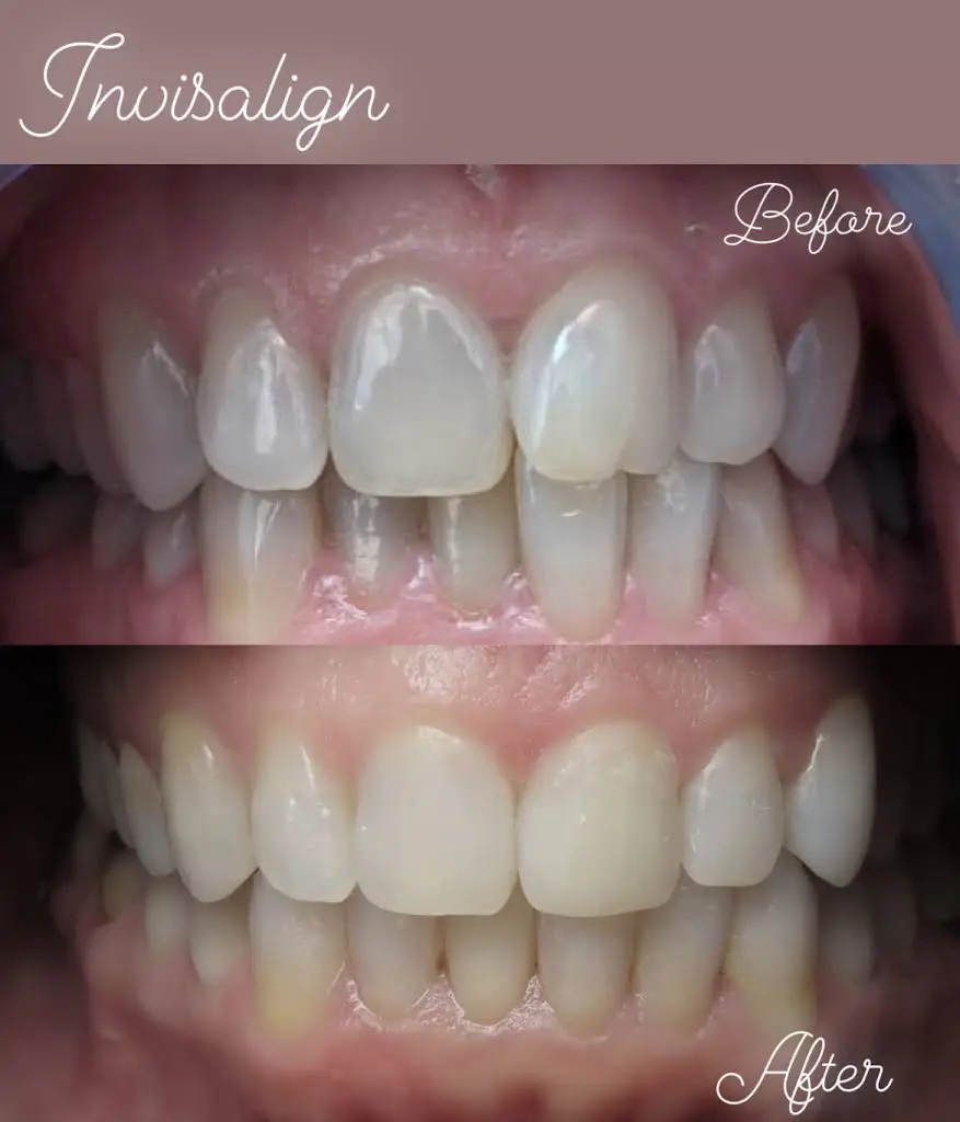 North Avenue Dental Care