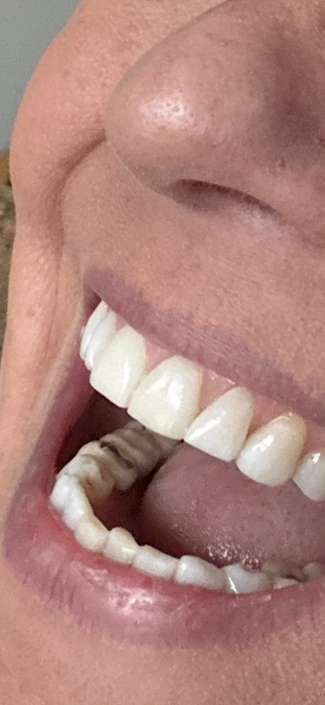 Bloomingdale Dental Care