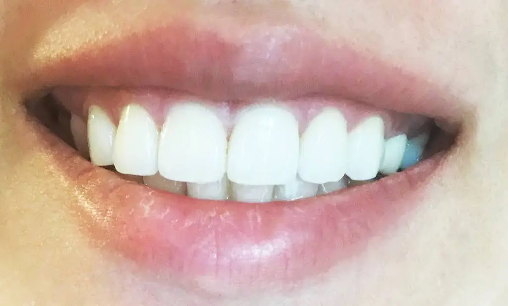 Hollywood Smile Dental