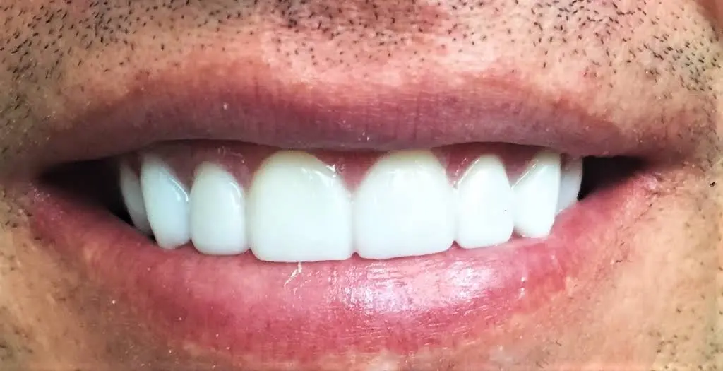 Hollywood Smile Dental