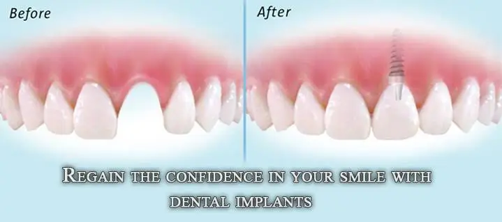 Yunez Dental
