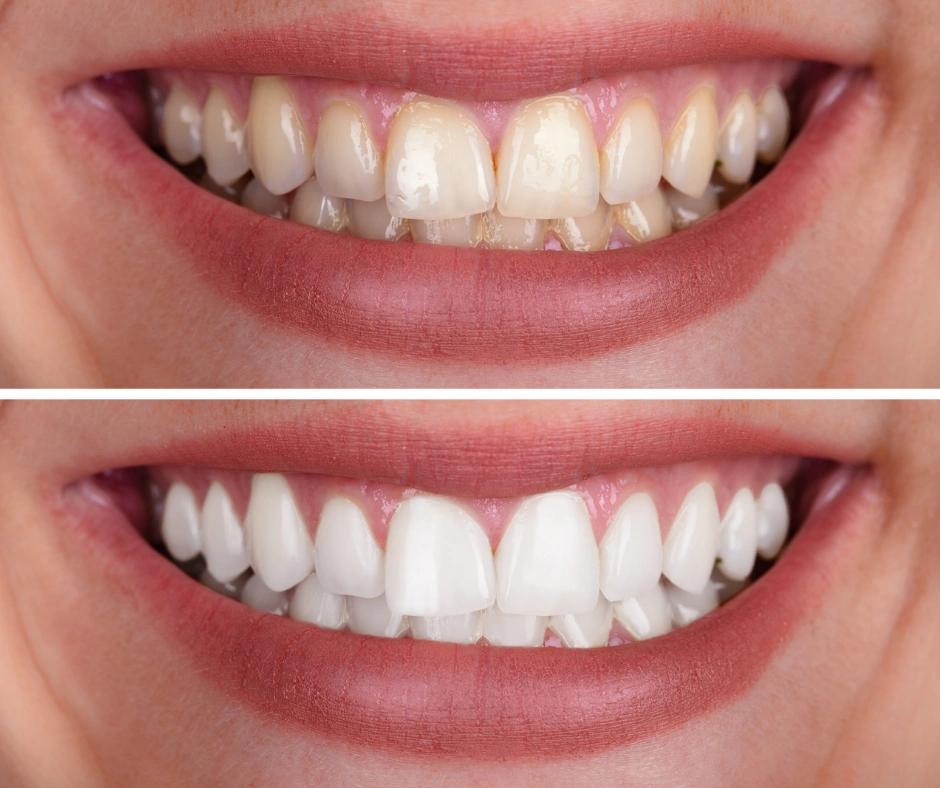 Silver State Dental