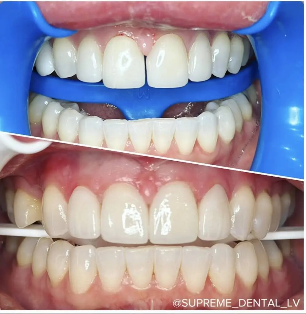 Supreme Dental