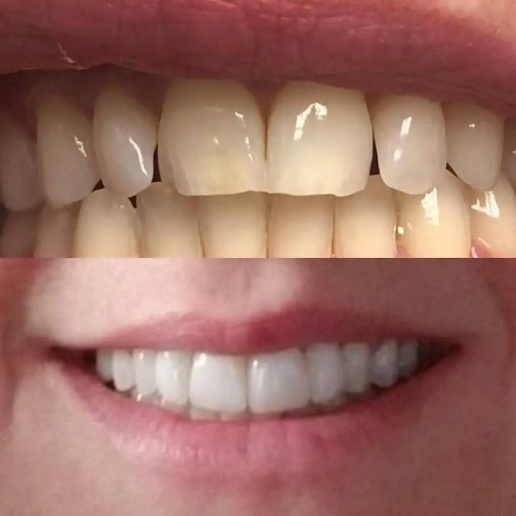 Absolute Dental