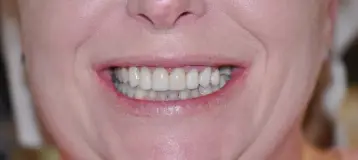 Willow Springs Dental